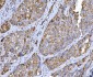 Anti-Beclin 1 Antibody Picoband™ (monoclonal, 2D12A3)